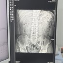 광명더나은정형외과의원 | 광명 하안사거리 허리디스크 통증으로 정형외과 방문, C-arm 신경차단주사 치료 후기