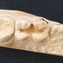 지안치과기공소 이미지