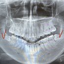 쏙쏙사랑니치과의원 이미지