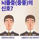 뇌졸중 전조 뇌졸중 초기 이미지