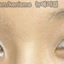 글리츠 이미지