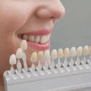 연치과기공소 네이버블로그