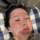케어인(주) | 신사피부과 포텐자 펌핑모드 모공축소 케어 후기 가격 엑소좀
