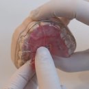 사랑치과기공소 이미지