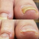 나비네일 이미지