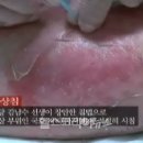 현대침구사