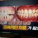 치통,치주염,잇몸 염증 치료사례/천기누설/기치유센터/기수련/기치료/자연요법/대체의학 이미지