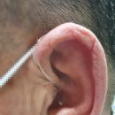 포낙보청기 이미지