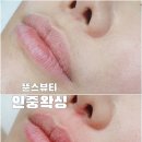 뚠스뷰티 네이버블로그