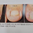 레푸스 화서역점 네이버블로그