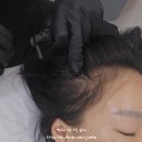 에테르노 | 전주 신시가지 전주두피관리 리얼 후기 : 에테르노전주점