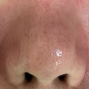 비타메인 | [광주 용봉동 피부관리] 결혼 준비 칙칙한 피부 고민? 청담스킨앤스파 용봉동 비타토닝 솔직 후기