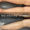 카라피부관리샵 | 천안 신방동 카라피부샵 하체관리 이화칠금 근테라피