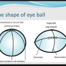 Zoom안경콘택트 | 하드렌즈 불편한 난시 교정