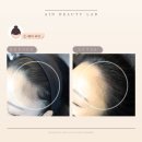 아인뷰티랩 이미지