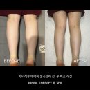 주물테라피