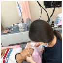 톱스타성형외과 | 얼굴 잡티제거하고 왔어요 _ 광주성형외과 _ 톱스타성형외과 _ 소프트 필 후기