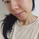 더블유피부과의원 | 강남역피부과 추천 볼뉴머 300샷후기 _박서준 리프팅