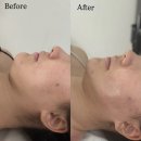 사임당로18길 7 (1) | 전후차이 최고 ! 잠실에스테틱 디어림 윤곽관리 솔직 후기 웨딩관리맛집