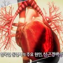 가슴편한내과 티스토리