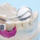 수 치과기공소 이미지