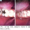 서울프로치과 네이버블로그
