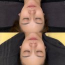 종합운동장역 9번출구 | ［ 송파 / 잠실 ] 종합운동장역 피부관리 테라비 윤곽컨투어링 작은얼굴만들기