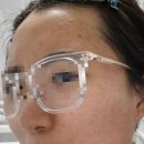 강북제일한의원 | 상계동한의원 얼굴흉터치료 천연재생침 리뷰