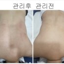 테라톡스