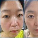 레그랩 라인포뮬러로 무거웠던 하체붓기 탈출 스토리 풀어봅니다.