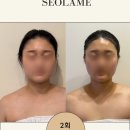 설아미 | 의정부피부관리 설아미 의정부본점에서 윤곽관리 받고 온 후기
