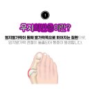웰손병원 네이버블로그
