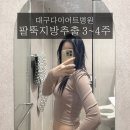 건강을 지키는 차생활 | 대구 반월당 팔뚝지방추출주사 3주차 라인 변화 리얼 후기