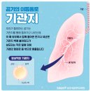 (주)아이비메디칼 | 시네츄라시럽, 아이들도 복용하는 3가지 이유와 부작용은?