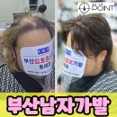 부산가발, 맞춤 남자가발 자연스러운 스타일 완성하기