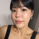 자연으로 | 강남역성형외과 입술필러 자연스러운 볼륨 내돈내산 후기