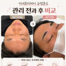 제주좋은사람홈케어 | 노형동남여눈썹 눈썹문신으로 인상이 또렷해진 [ 미녀뷰티케어 ]