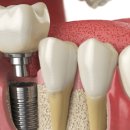 동구이편한치과의원 이미지