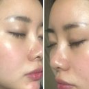 진인한의원 | 부산 주사피부염으로 피부과 세곳 다녀와보고 쓰는 일기