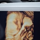 다솔한의원 | 현미베이크 오븐에 구운 꼬꼬리그, 냠냠과수원 숙성꿀, 다솔아동병원 BCG주사, 1차 영유아검진...