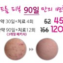 서면대성한의원 네이버블로그