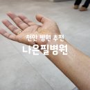 천안나은병원 | 천안 정형외과 수술 병원 추천 나은필병원 결절종 수술 후기