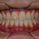 의정부본플란트치과의원 이미지