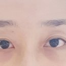 포베리 이미지