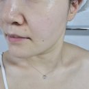 당독소케어 | 리코일 항당화세럼 저속노화 안티에이징 케어 시작한 후기