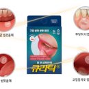 티비엠