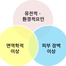 한솔컴즈 | 아토피 피부염 예방을 위한 생활 지침