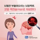 뇌 동맥류 - 카톨릭 성모병원 이미지