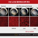 ANG Bio(에이앤지 바이오) | [올릭스] 황반변성 파이프라인 전망 보고서 2025