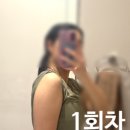 으라차차멍 | 명동비만클리닉 팔뚝지방분해주사 내돈내산 후기 팔뚝제로팻효과 4회차